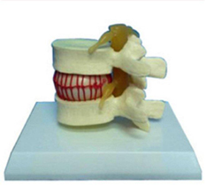 Vertebrae Model With Light Pharmaceutical and Anatomical Model Gifts